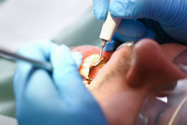 Best Chipped Tooth Repair Near Me  in Jamestown, NC