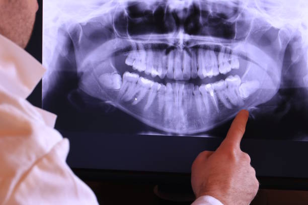 Best Emergency Gum Pain Relief  in Jamestown, NC