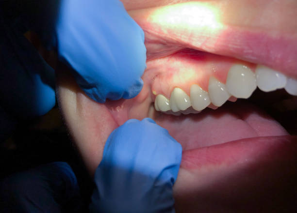 Best Cracked Tooth Emergency Dentist  in Jamestown, NC