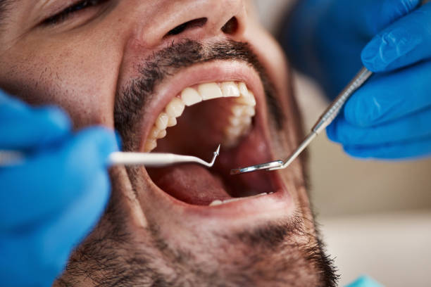 Best Root Canal Emergency Dentist  in Jamestown, NC