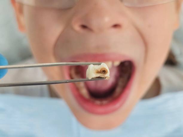 Best Emergency Pediatric Dentist  in Jamestown, NC